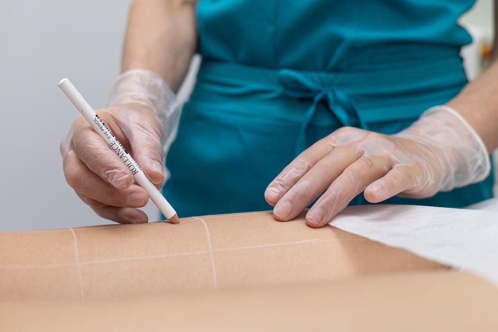 Μόνιμη Αποτρίχωση MT One Diamond Diode Laser - Miss Skin