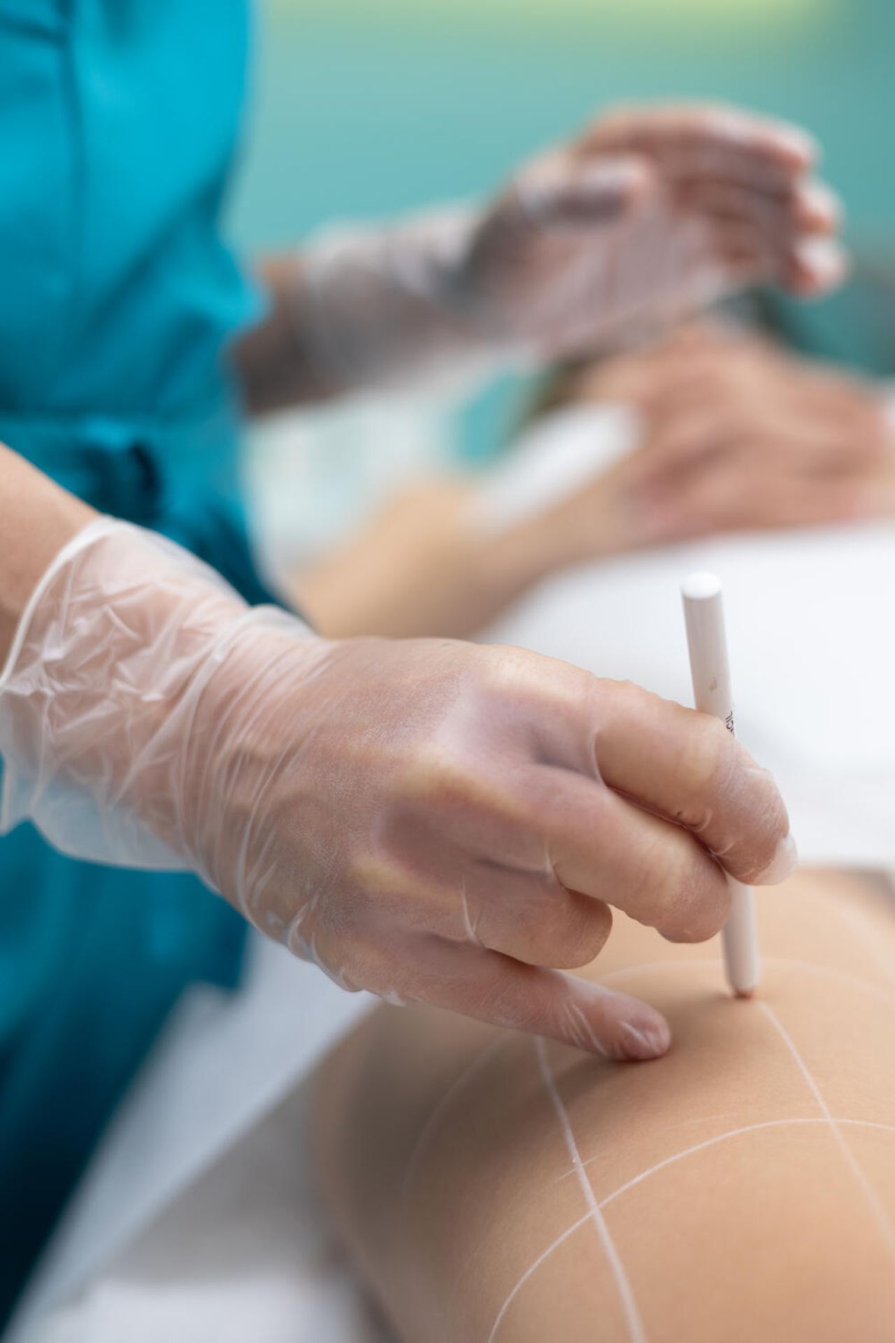 Μόνιμη Αποτρίχωση MT One Diamond Diode Laser - Miss Skin