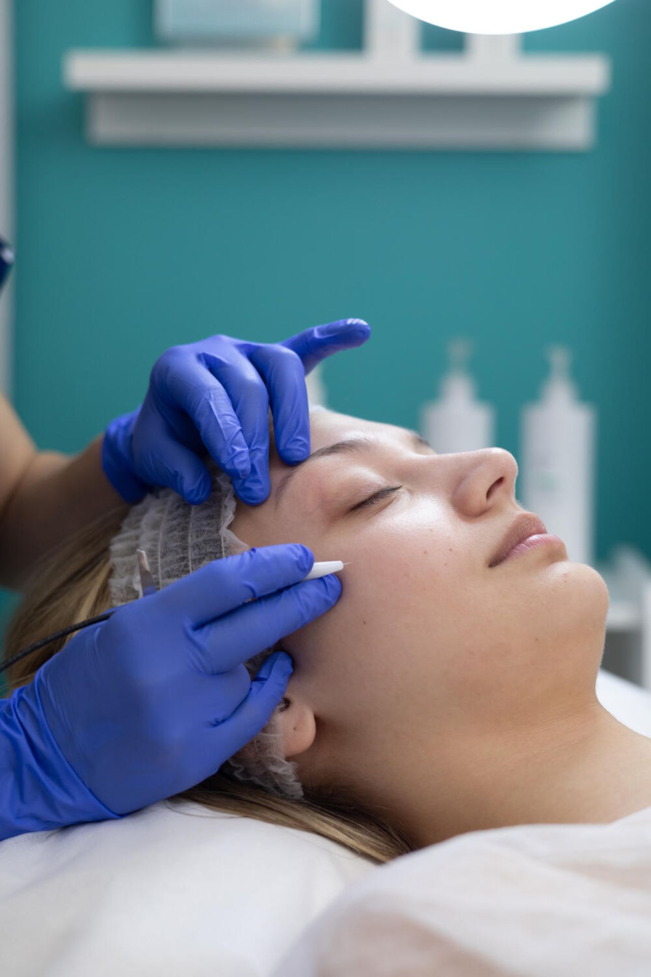 Ριζική Αποτρίχωση Apilus Center - Miss Skin